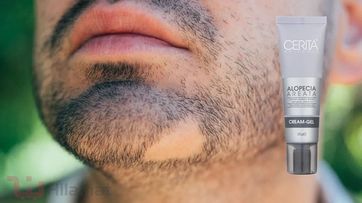 ژل مناسب ریزش سکه ای